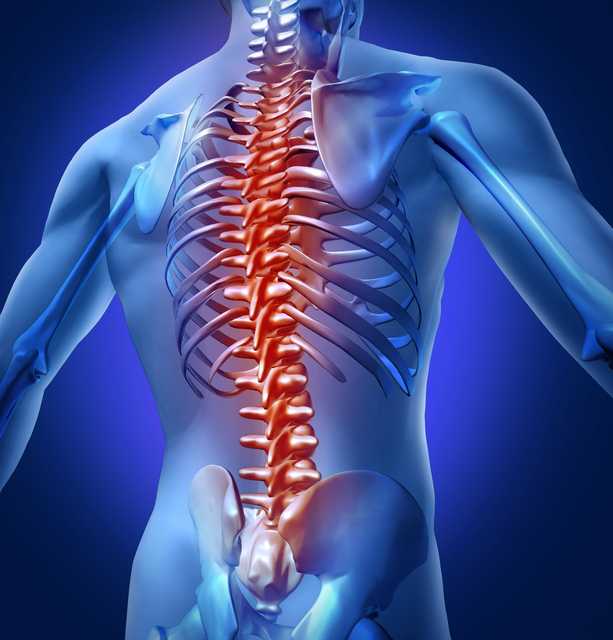 Handling cauda equina syndrome when it hits - Vimarsana News