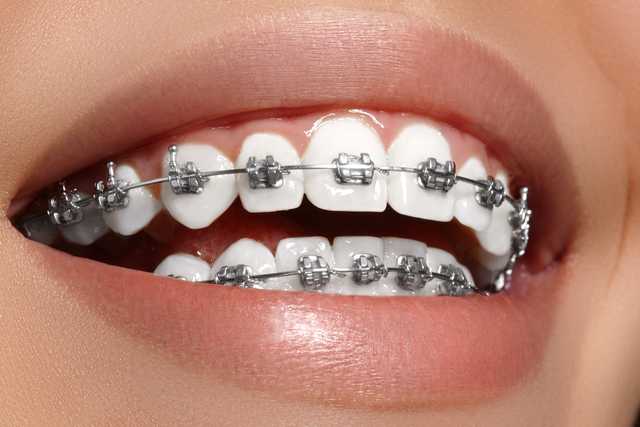 Understanding the field of orthodontics - Vimarsana News