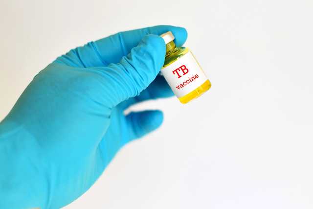 Shorter drug duration to improve TB treatment - Vimarsana News