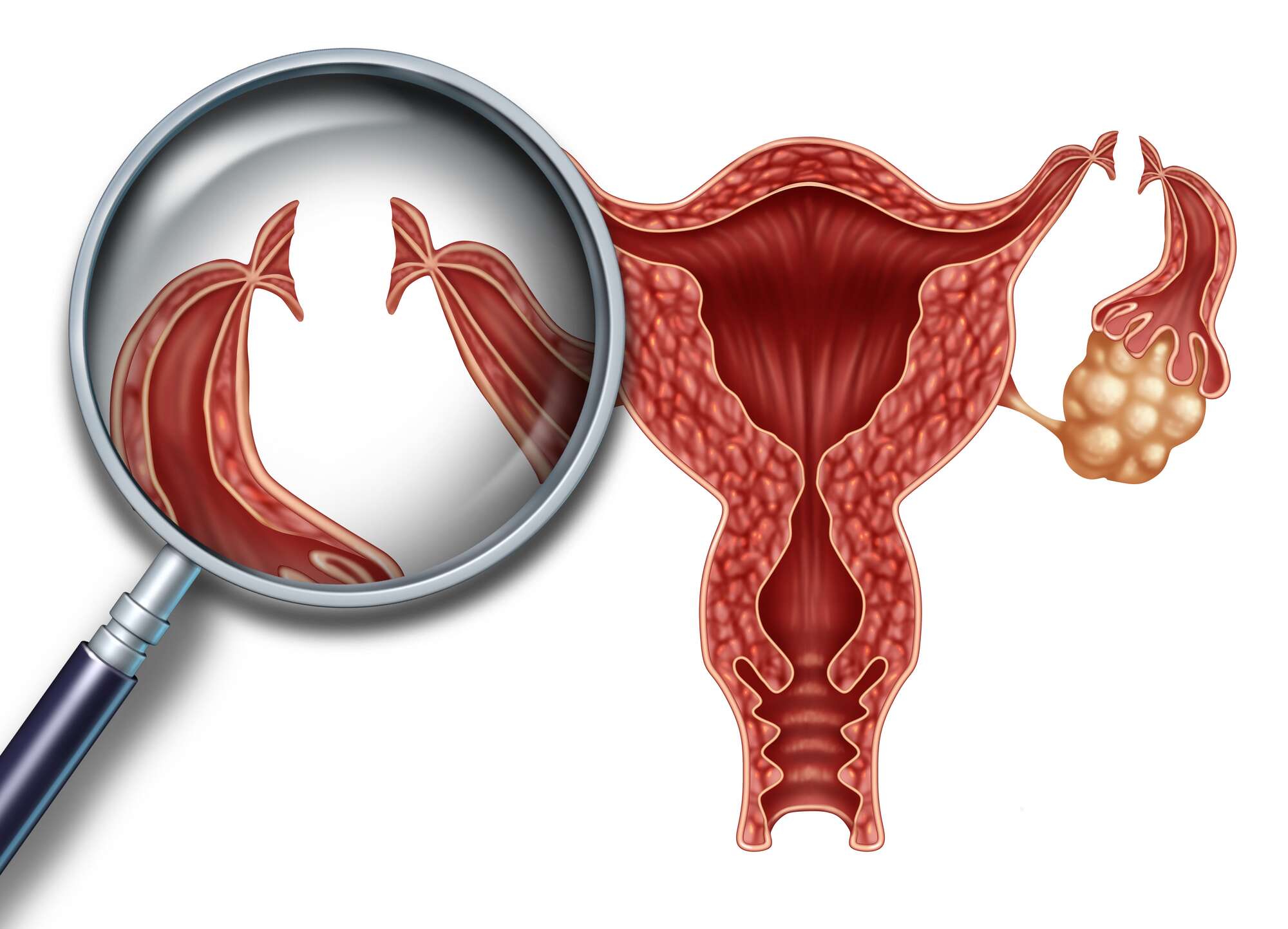 More Kenyans opting for permanent birth control - Vimarsana News
