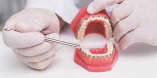 DENTALBRACES